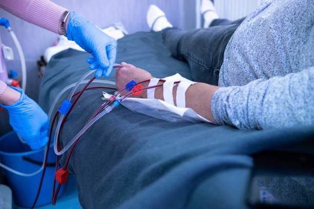 Κατανόηση των βασικών στοιχείων: Πώς λειτουργεί η αιμοκάθαρση και η σημασία της